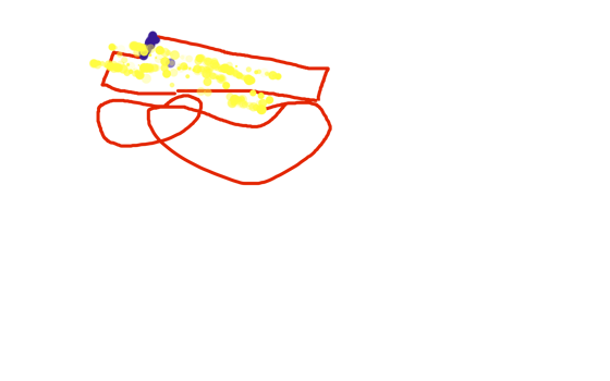 Skoterbilen